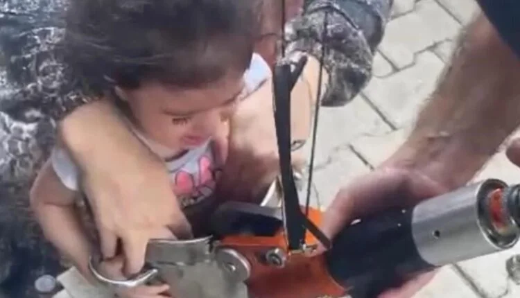 عملية إنقاذ فريدة لطفلة علقت داخل قدر ضغط!